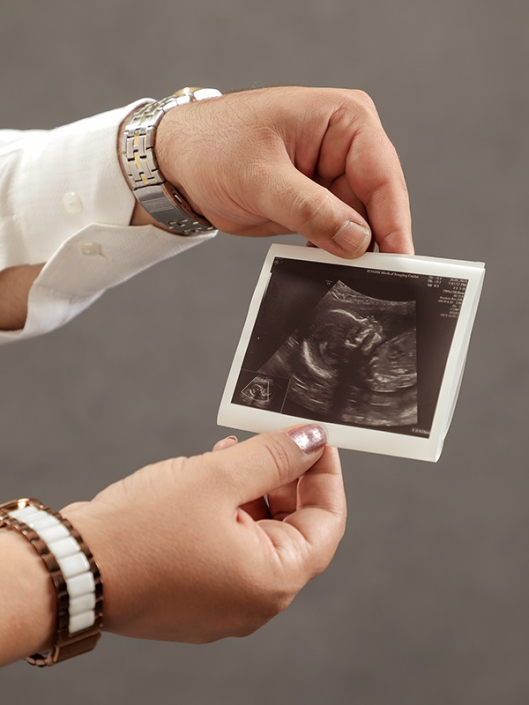 عکاسی با سونوگرافی بارداری
